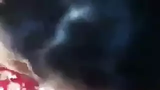 تجميل الوجه بعد اللسان من شاب هندي